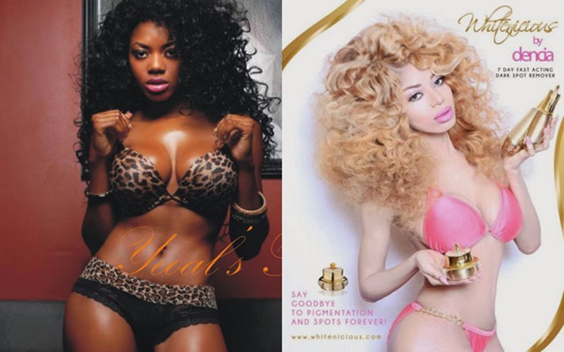 Singer Dencia Under Fire for Promoting Skin Whitening Cream To Young Girls