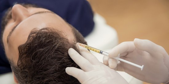 PRP Hair Loss injections